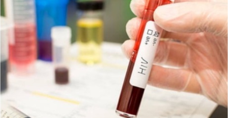 HIV-2